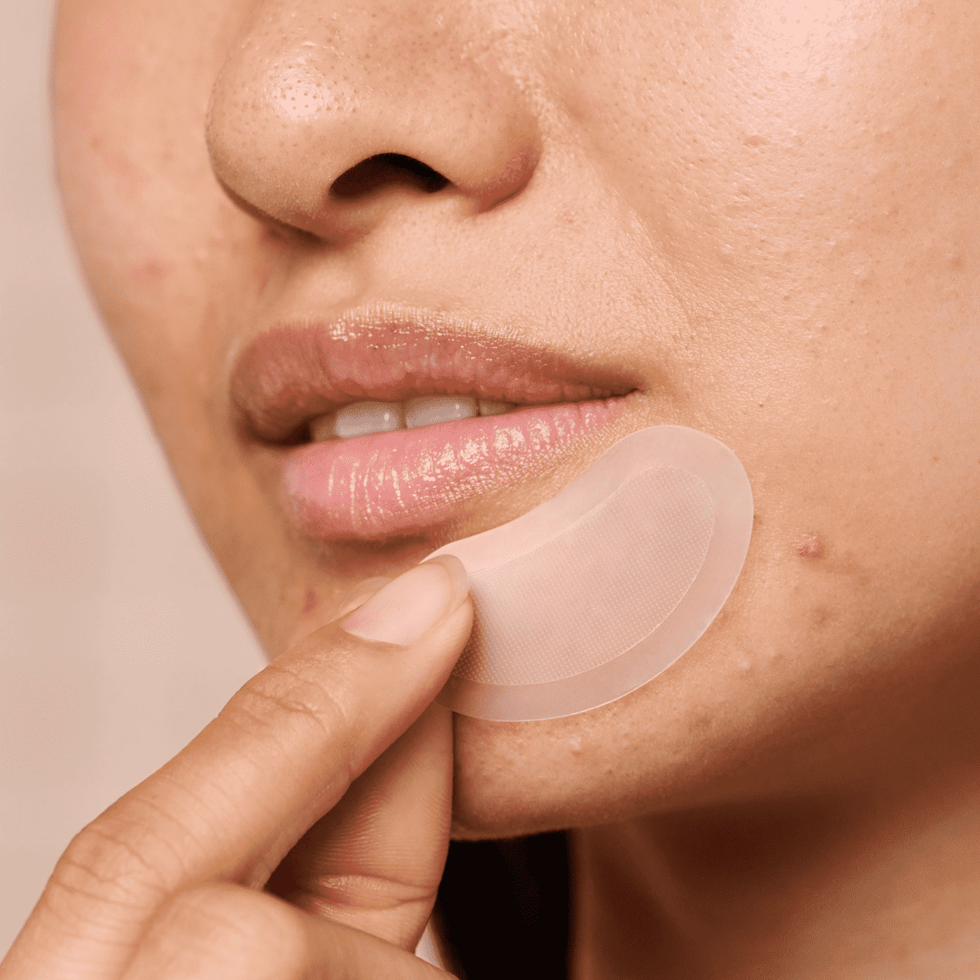 Mighty Patch™ for XL Early-Stage Blemishes - Outdoor Ready