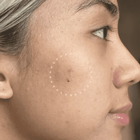 Mighty Patch™ for Dark Spots - Modern Pick