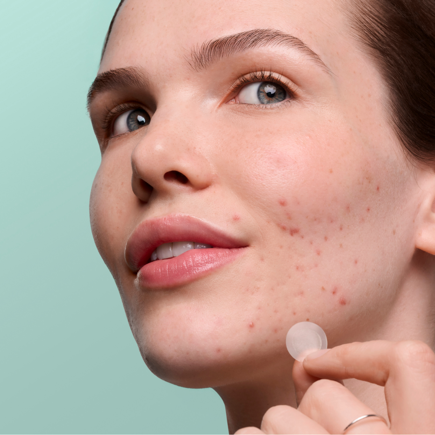 Pimple Patrol Duo - Essential Style